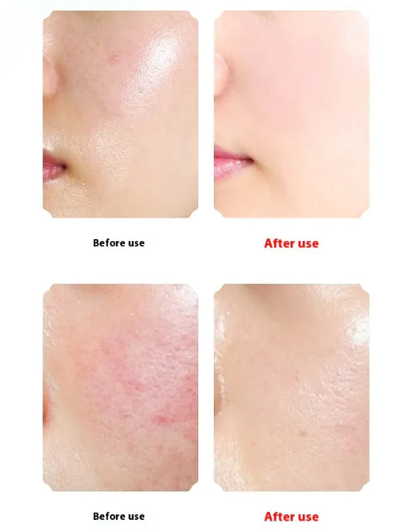 Thermal Sonic Facial Brush